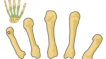 Osteoporosis Singapore