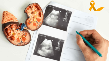 Detecting and Treating Kidney Cancer: Insights from a Specialist